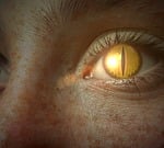 eye, reptilian eye, eyelashes