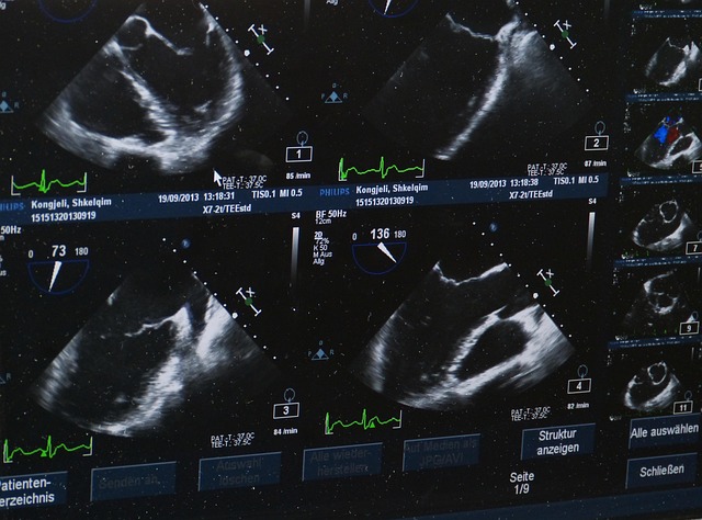 ultrasound, x-ray image, hospital, doctor, medicine, health, health check, disease, pension, examination, advertisement, investigate, heal, clinic, picture, organ, ultrasound, ultrasound, ultrasound, ultrasound, ultrasound