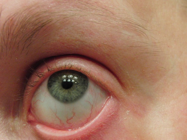 Free Eye Macro photo and picture