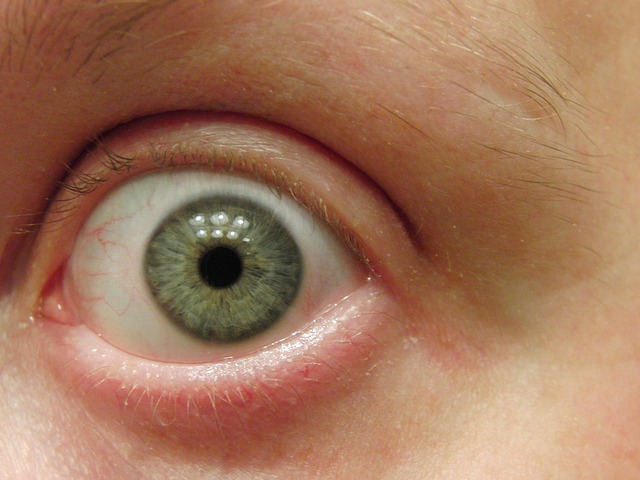Free Eye Macro photo and picture