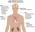 anatomy of the human body, big picture, hypertension