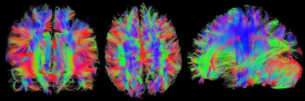 Free Brain Mrt illustration and picture