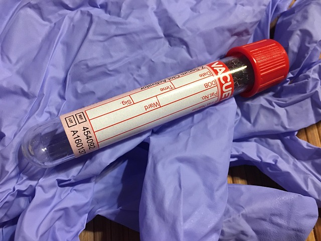Free Test Tube Download photo and picture