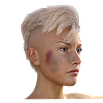 woman, haematoma, fight
