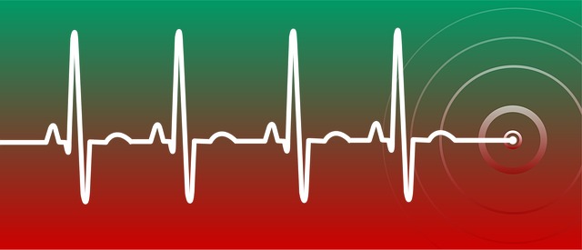 Free heartbeat pulse ecg illustration