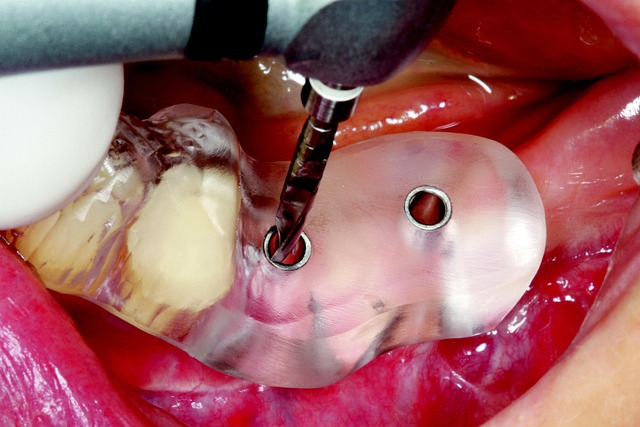 Cerec, Guide, Two