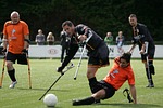 football, game, amputation