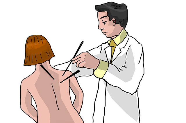 Free acupuncture acupuncturist alternative illustration