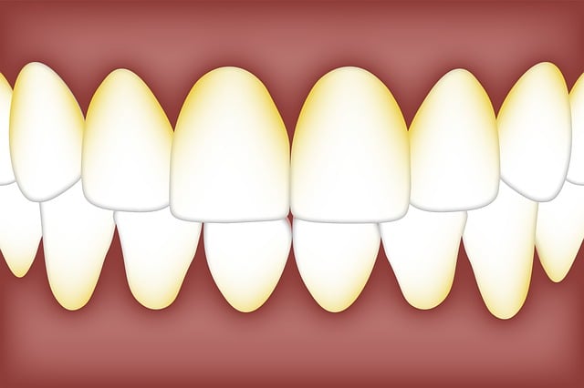 Free dental plaque biofilm illustration
