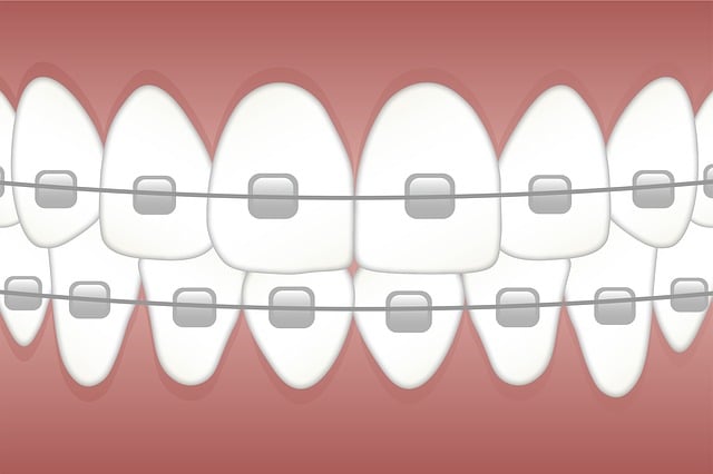 Free braces teeth dentist illustration