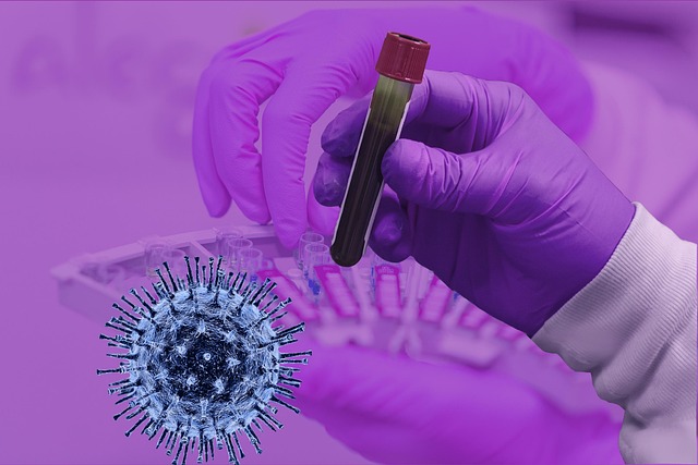 covid-19, coronavirus, epidemic, infection, exam, laboratory, medical, pathogen, corona-virus, laboratory, laboratory, laboratory, laboratory, laboratory