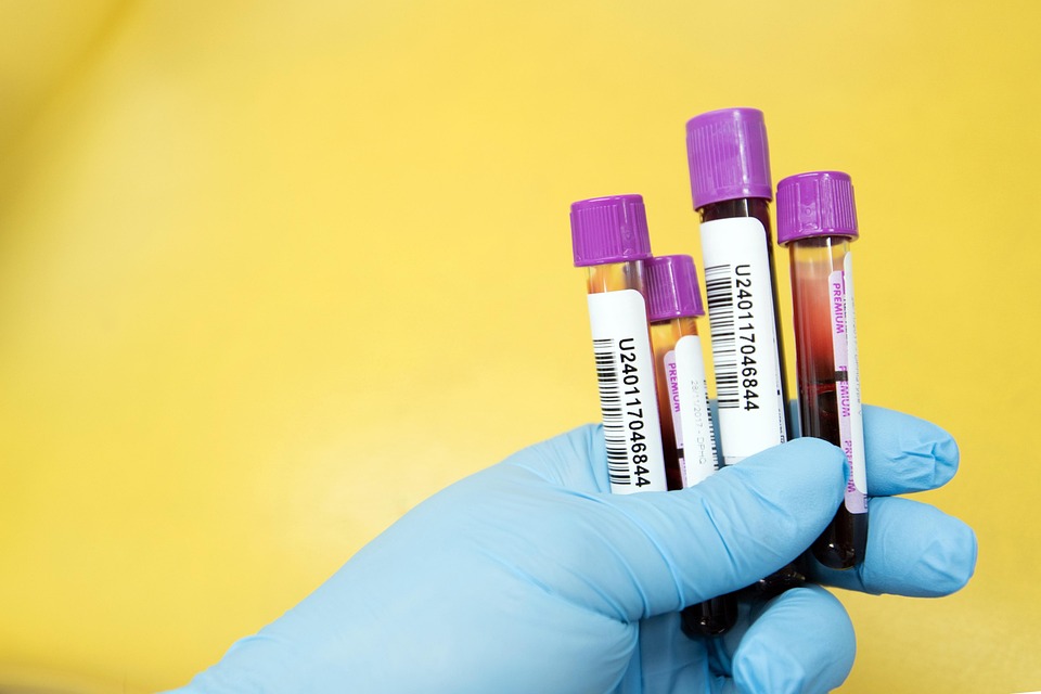 La Sangre, Muestra, Laboratorio, Científico, Prueba