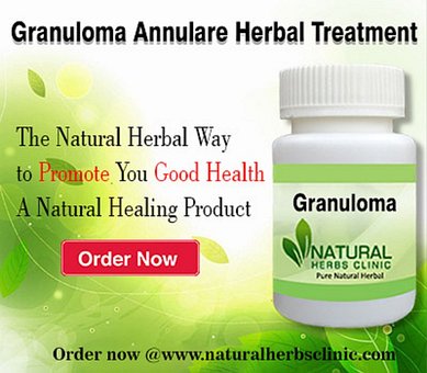 El Granuloma Anular