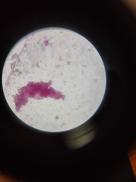 Free Ecoli Microscope photo and picture