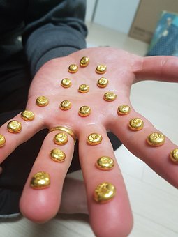 Manos Doradas, Oro, Mano