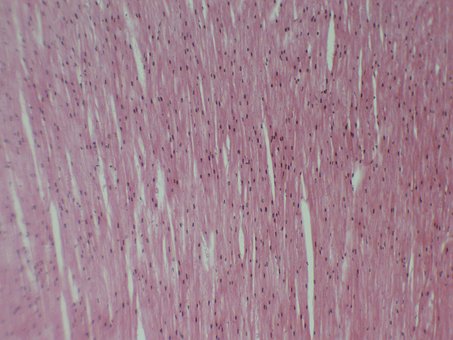 Free Heart Muscle Dog photo and picture