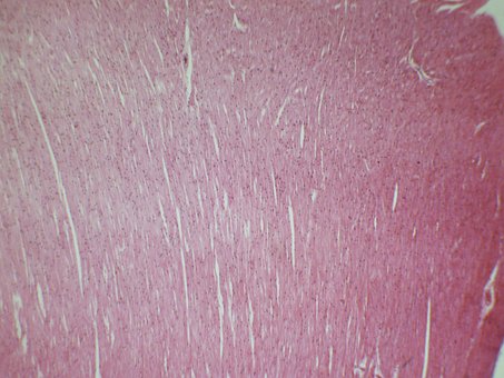 Free Heart Muscle Dog photo and picture