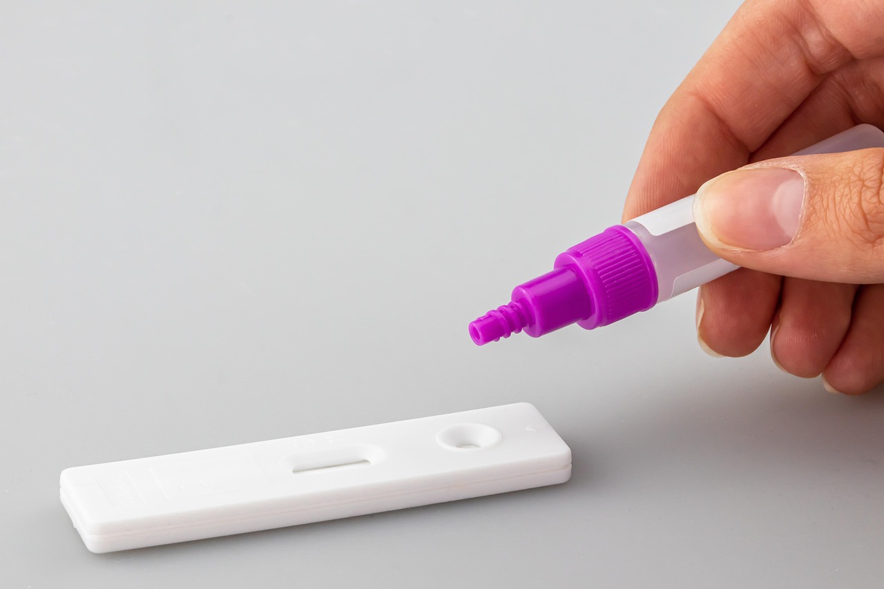 Prompt Injection Testing in CI: Building a Regression Suite for Agents