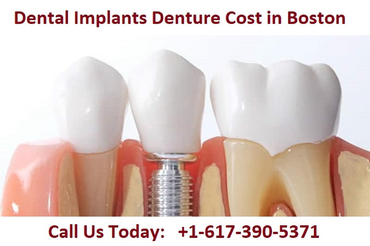Dental Implant Denture Cost Boston Free photo on Pixabay Pixabay