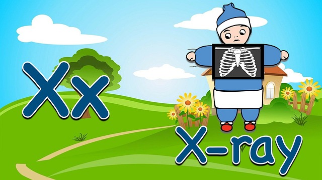 letter x, alphabet letters, x-ray, sounds, letters, reading, spelling, phonics, preschool, flashcards, letter x, letter x, alphabet letters, alphabet letters, alphabet letters, x-ray, x-ray, x-ray, x-ray, x-ray, phonics, phonics, phonics, phonics