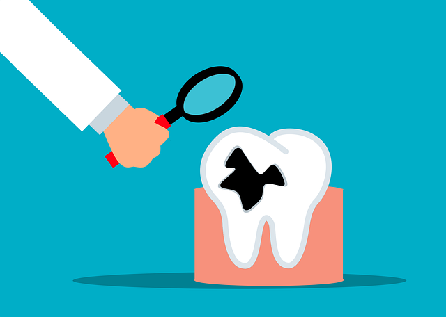 Free tooth decay dentist dental vector
