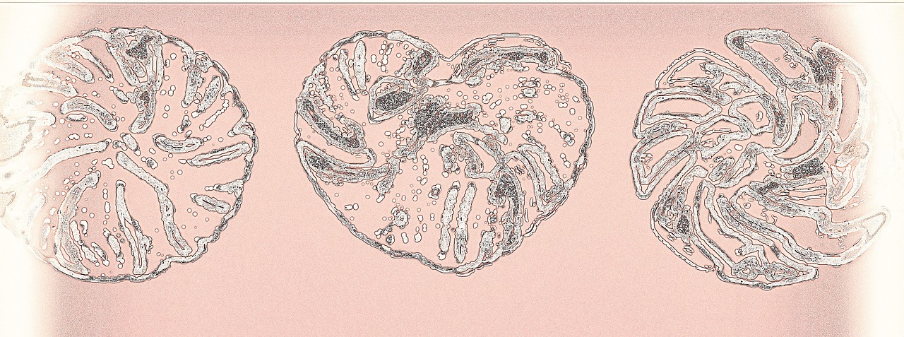 The Role of Lifestyle and Diet in Heart Health