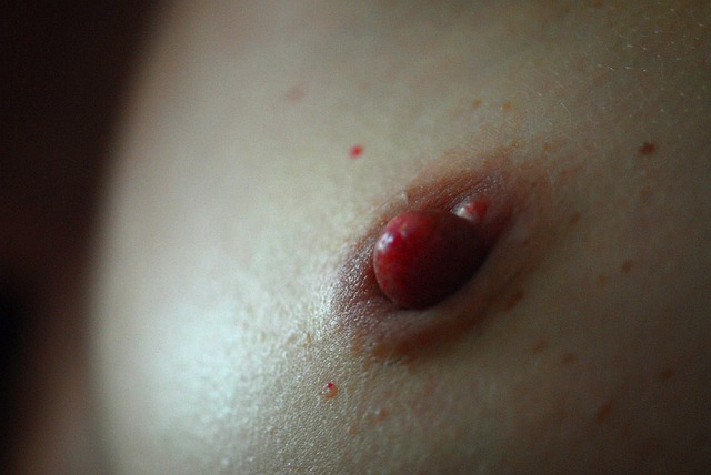 Areola, Kvinde, Hud