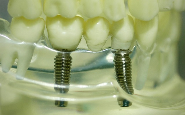 Dental Tooth Teeth - Free photo on Pixabay - Pixabay