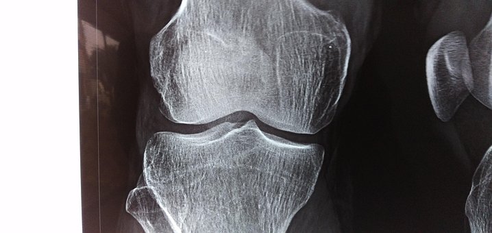 Free X-Ray Radiology photo and picture