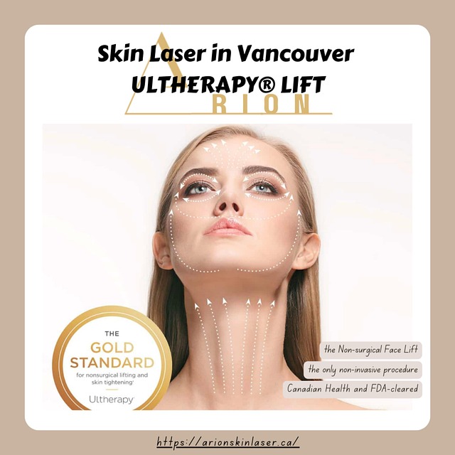 Vancouver Skin Laser Free photo on Pixabay Pixabay