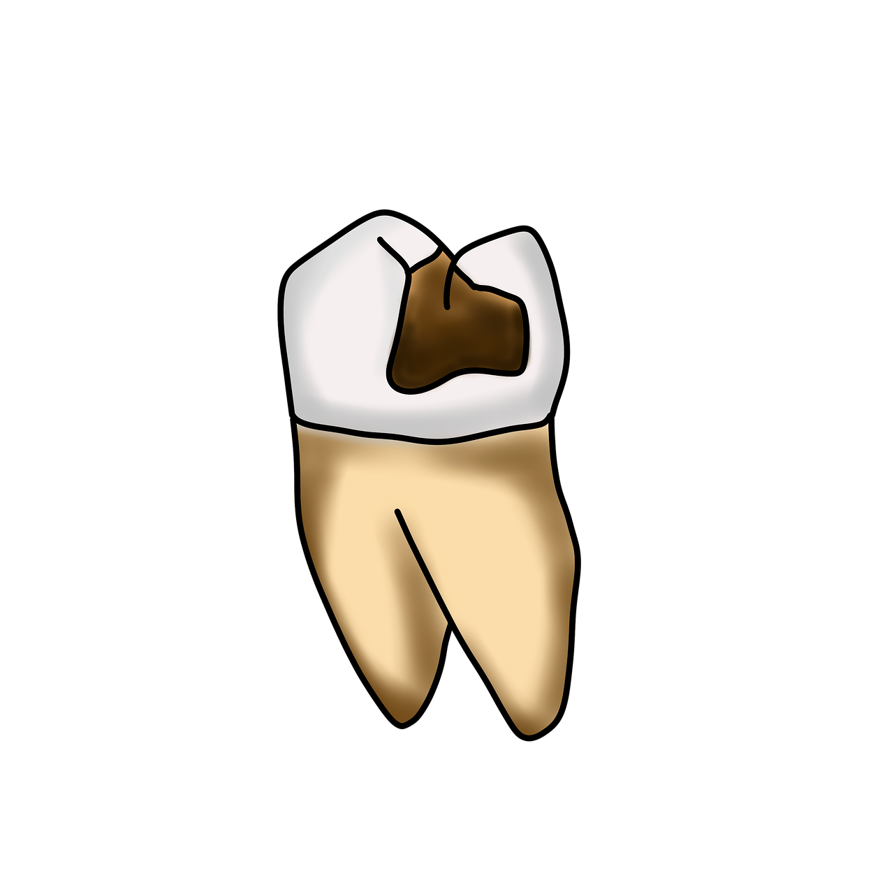 Download Caries, Dental, Teeth. RoyaltyFree Stock Illustration Image