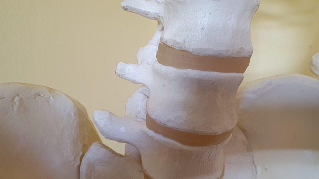 Lumbar Vertebrae Intervertebral Free photo on Pixabay Pixabay