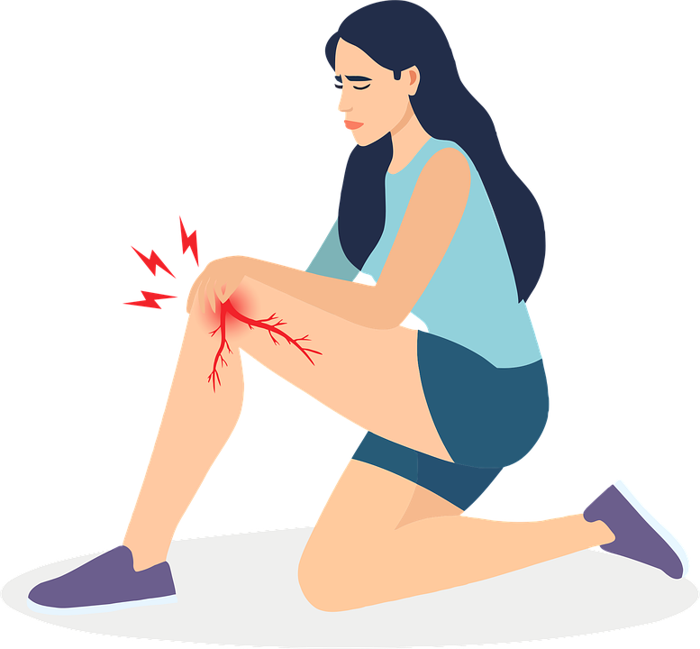 Illustration of a woman experiencing knee pain after a fall