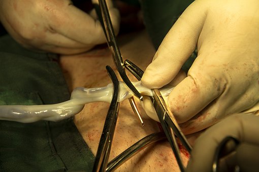 Free Cordon Umbilical photo and picture