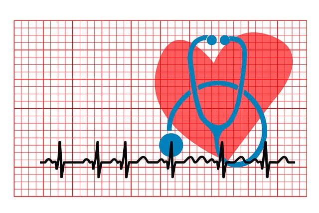 Free arrhythmia palpitations heartbeat illustration