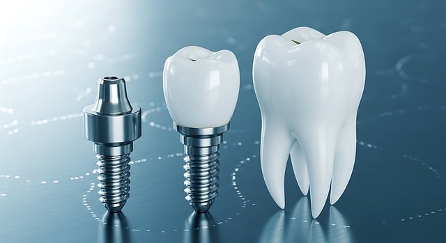 Free dental implant tooth dentistry illustration