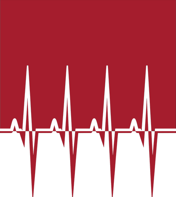 Elektrokardiogramm, Herzmonitor